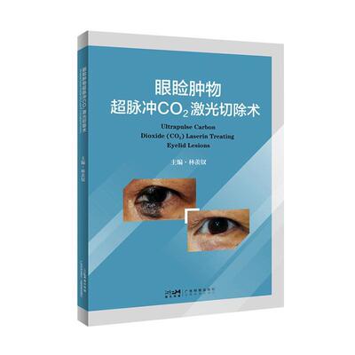 眼睑肿物超脉冲CO2激光切除术林羡钗  自由组套书籍