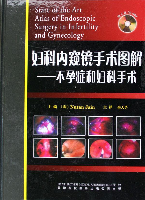 妇科内窥镜手术图解:不孕症和妇科手术岳天孚 内窥镜应用不孕症妇科外科手术图医药卫生书籍