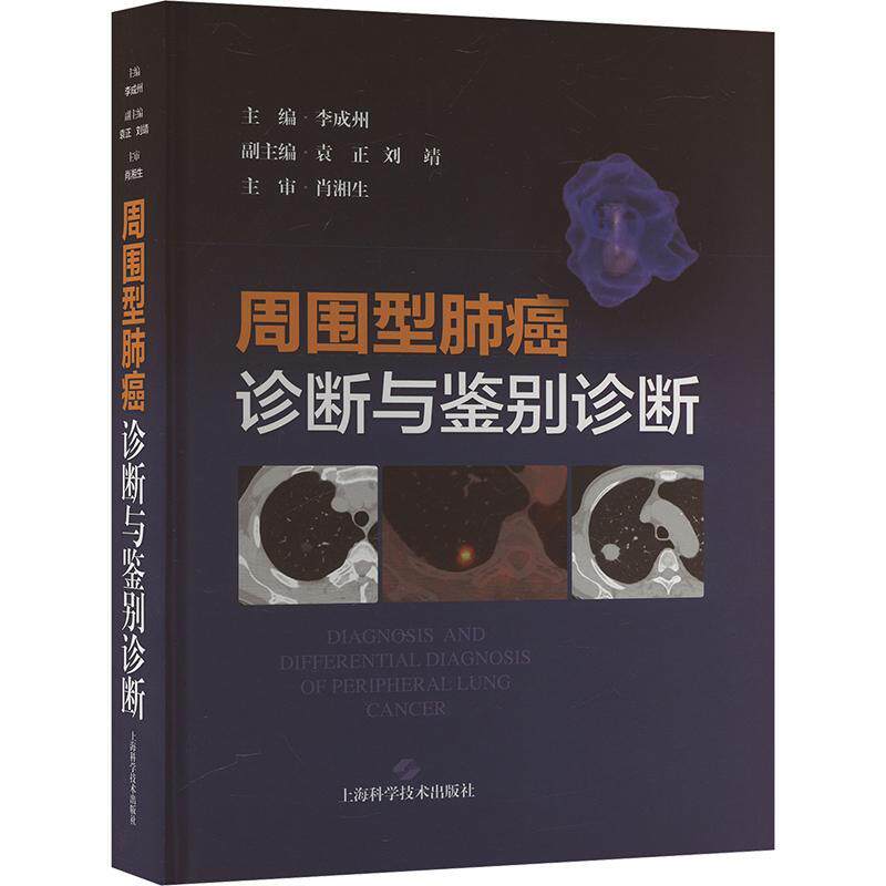 周围型肺癌诊断与鉴别诊断李成州 医药卫生书籍