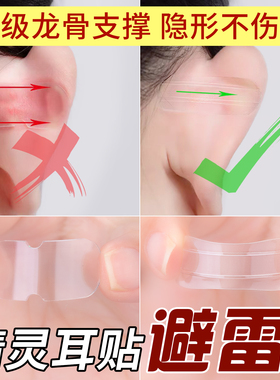 隐形龙骨精灵精精耳贴强支撑立耳装饰女生显脸小招风耳朵外扩神器