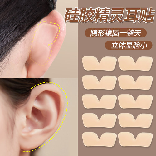 蝶翼型隐形精灵耳贴强支撑
