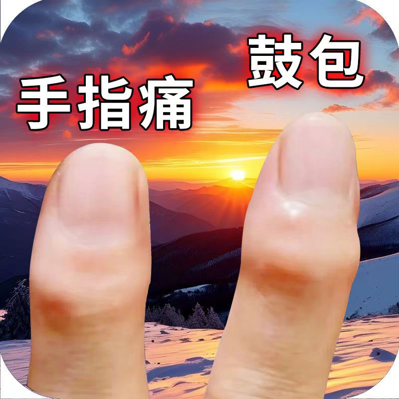 手指关节变形肿大粗大增生疼痛酸麻僵硬类风湿性关节焱