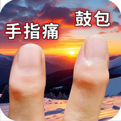 手指肿大粗大增生酸麻僵硬类