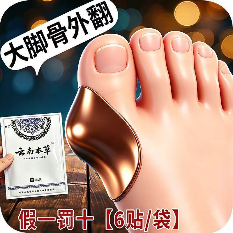 【官方正品】严重大脚骨外翻拇外翻贴拇指外翻肿胀变形脚趾重叠贴