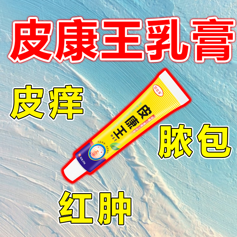 皮康王乳膏腿痒晚上遇冷大小腿痒身上痒的受不了脚面痒季节性痒