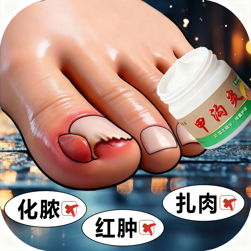 大拇指往肉里长脚趾缝脚指甲疼销肿感染发红肿化脓脚指甲止痛膏