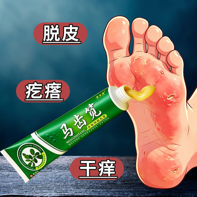 马齿苋草本乳膏15g皮肤外用脚底手部身体干痒护理软膏