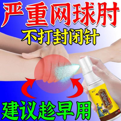 网球纣专用喷剂手肘关节疼痛僵硬胳膊抬不起护肘喷剂