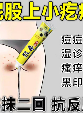 屁股上长痘痘痒起热疙瘩坐板疮藓拔毒膏久坐私处膏屁眼痒