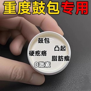 官方正品强效肿块膏脂肪灵皮下硬块多发性涂抹膏脂肪鼓包小颗粒