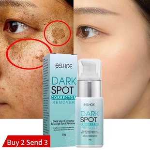 Dark Skin Spot Freckle Cream Whitening Remover Nicotinamide