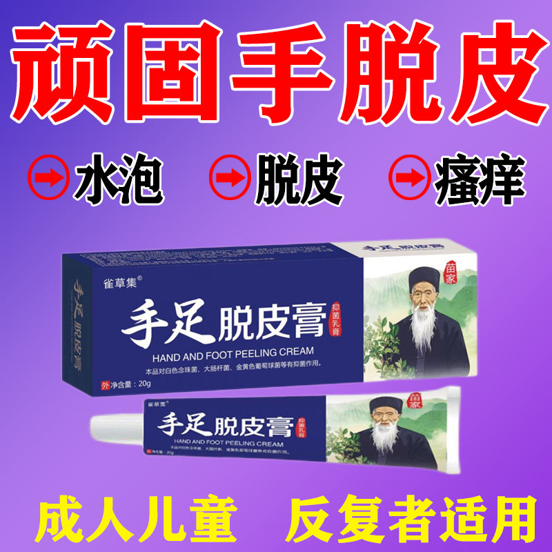 儿童手足脱皮膏手指脚蜕皮干裂起水泡严重反复季节性倒刺防裂滋润