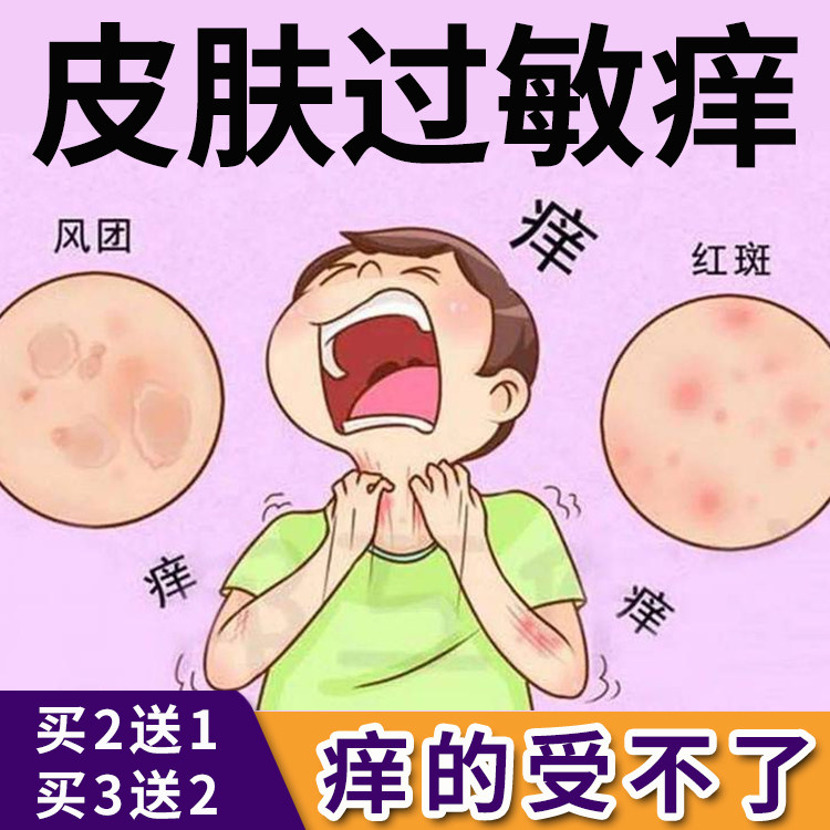 接触性皮肤过敏金属过敏化学品接触皮肤红肿水泡丘疹瘙痒抗过敏膏