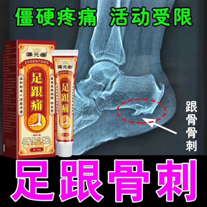 足跟痛骨刺足底筋膜炎脚掌疼痛