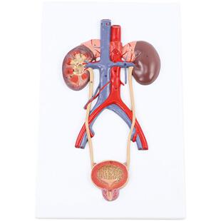 人体泌尿系统模型输尿管膀胱尿道模型肾解剖模型医学泌尿系统外科