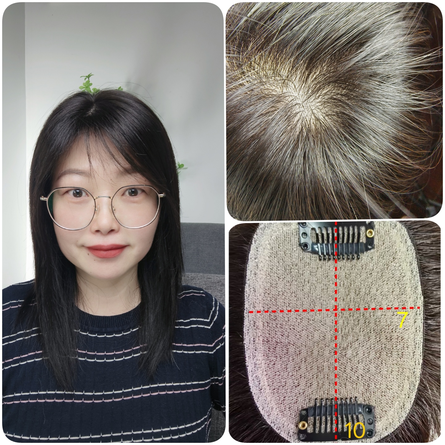 顺心假发片女真发无痕隐形全递针头顶补发片真人发丝发顶遮盖白发