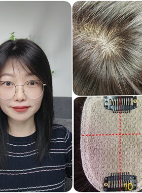 顺心假发片女真发无痕隐形全递针头顶补发片真人发丝发顶遮盖白发