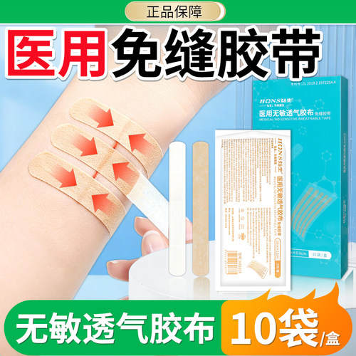 医用减张贴术后伤口皮肤减张器