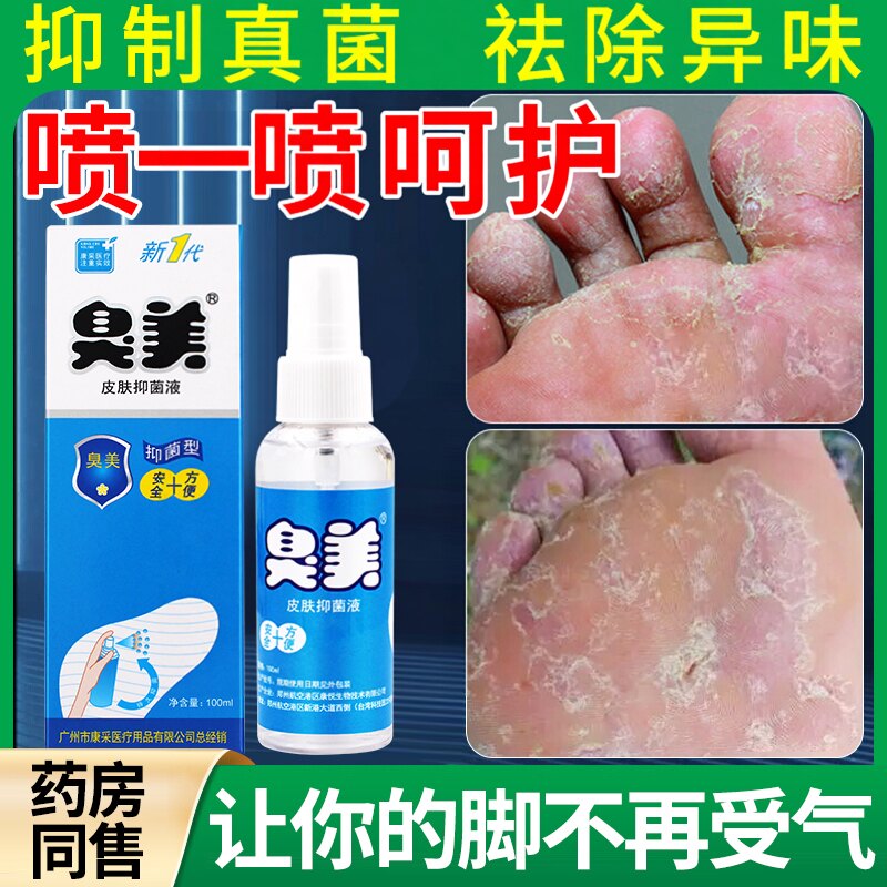 臭美脚气药喷雾抑菌膏