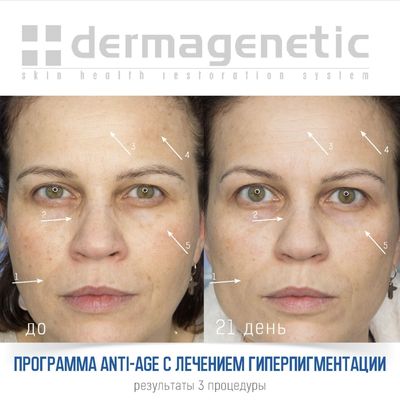 DERMAGENETIC提亮嫩白收紧面霜
