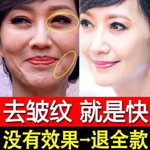 除皱纹神器去抬头纹祛皱抗皱提拉紧致面霜美白去皱抗衰老护肤品霜