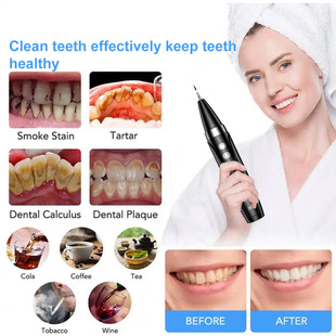 口腔清洁器洁牙清洁牙结石黄Plaque Remover for Teeth可视洁牙仪