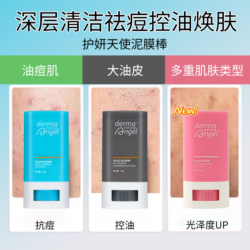 护妍天使清洁祛痘泥膜棒去黑头闭口祛粉刺清洁保湿控油涂抹面膜棒