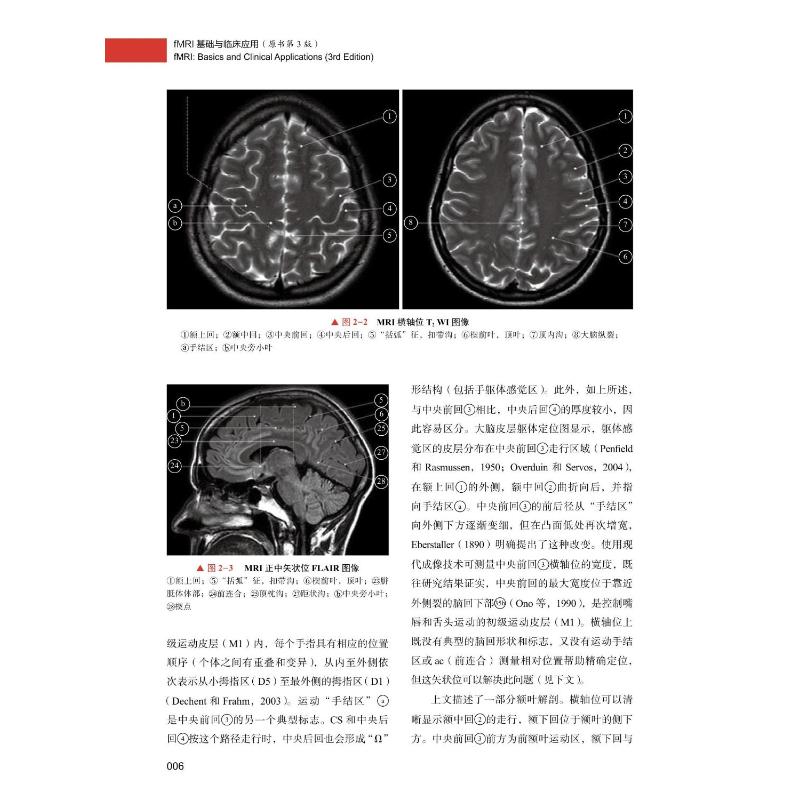 FMRI基础与临床应用(原书第3版) (瑞士)史蒂芬·奥尔默,(德)奥拉夫·詹森 著 卢洁 译 外科 生活 中国科学技术出版社 图书