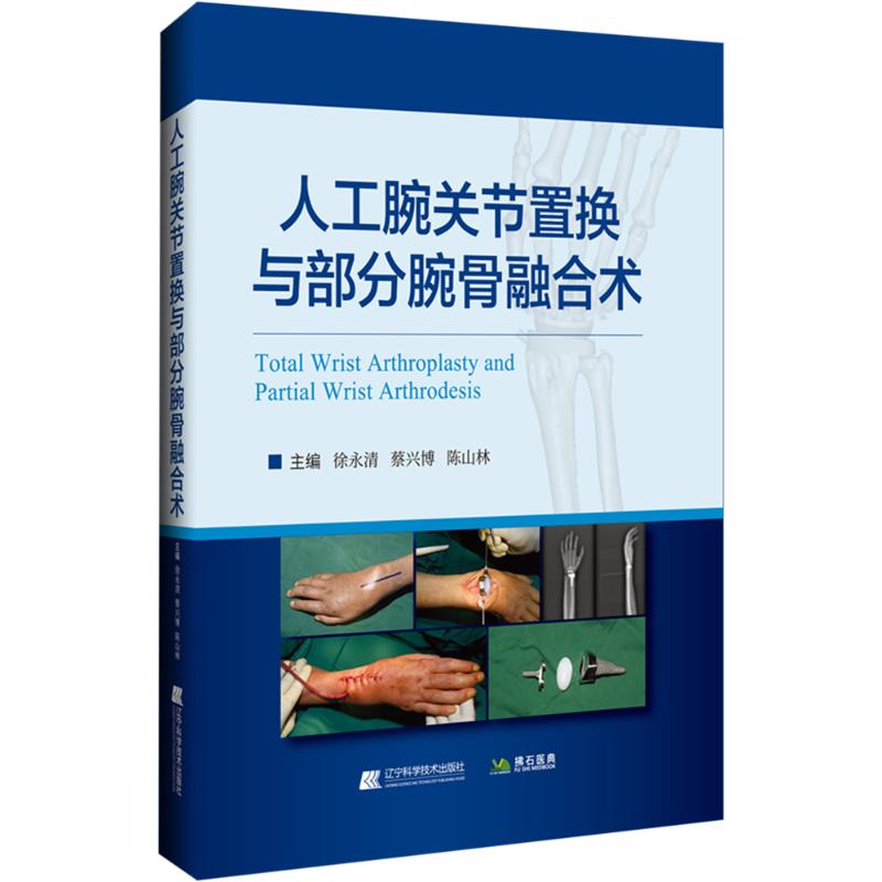 人工腕关节置换与部分腕骨融合术 外科