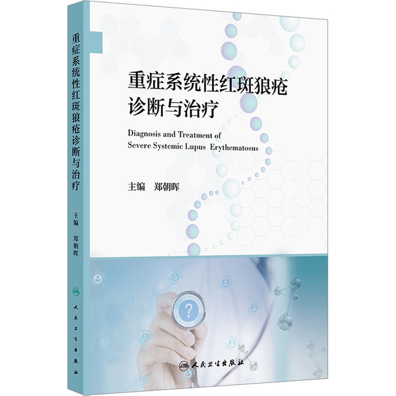 重症系统性红斑狼疮诊断与治疗内科