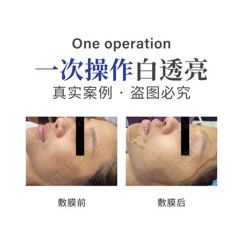 院线美容院专用护肤品草本面膜粉 纯中美药白七子白软模粉