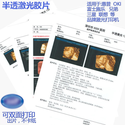 半透明激光医院用胶片 彩色激光双面打印胶片B超彩超胃镜科室用胶