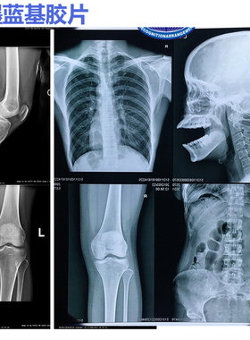 医院用喷墨打印蓝基放射胶片DR CR CT X光MR磁共振喷墨蓝片彩色成