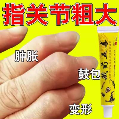 手指关节疼痛专用膏药关节变形肿大僵硬类风湿骨性关节炎贴膏神器