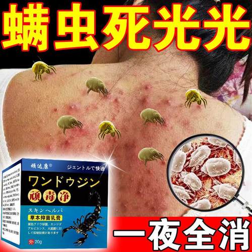 螨虫膏人用TNZ药螨叮咬止虫痒神器脸上过敏除螨痘毛孔祛粗大粉刺