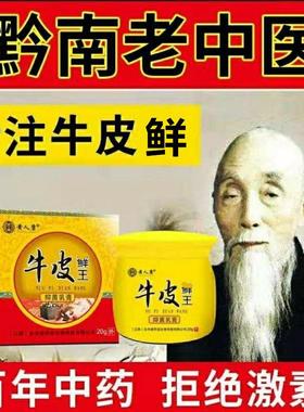 菌牛皮鲜乳鲜膏止GVR痒抑康头鲜股鲜手足黄人牛皮鲜王外用