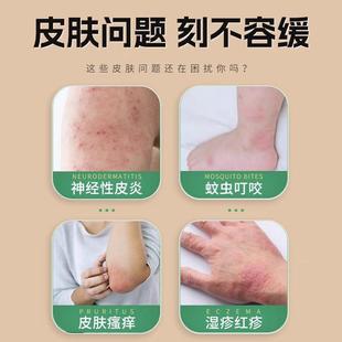 土茯抑菌菌膏黄皮肤抑止痒乳膏皮肤外用湿热NOM苓膏疹手脚藓软官