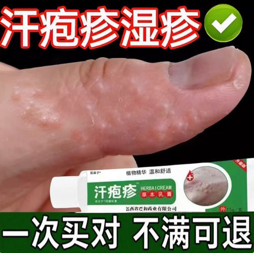 【专攻汗疱疹】手上起小水泡专用