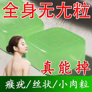 扁平疣去除软膏一抹灵去疣尤瘊用专根斩草除根祛疣小肉粒药膏医用