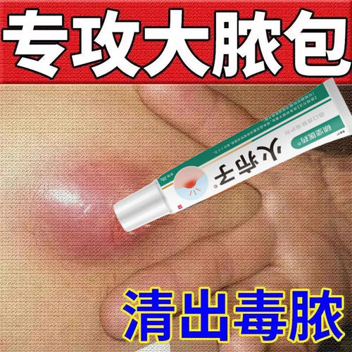 【消肿止痛】火疖子拔毒拔脓药膏