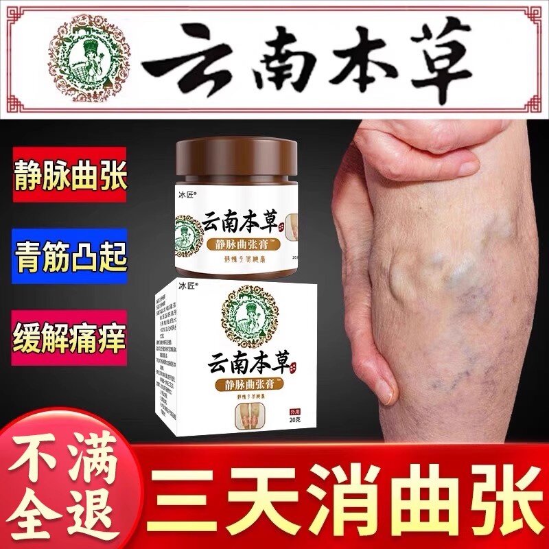 静脉曲张蚯蚓腿血管肿胀腿部青筋凸起凝胶扩张药膏精索红血丝贴膏