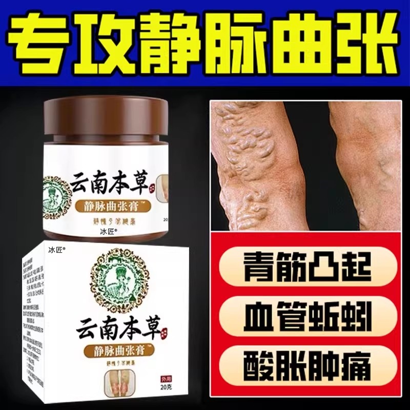 【平静脉消曲张】静脉曲张药膏