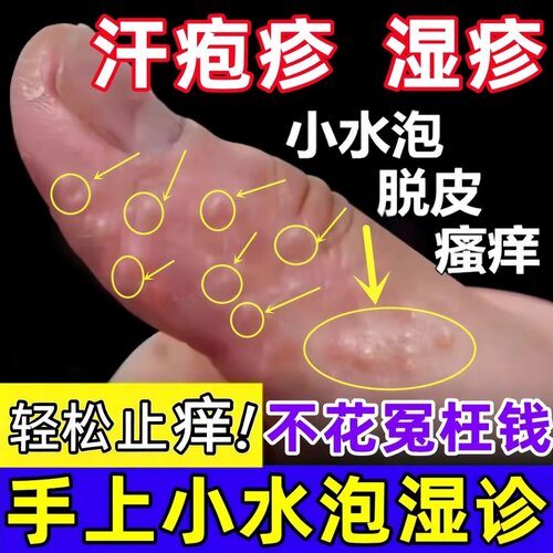 正品】云南本草汗泡疱珍疹药膏