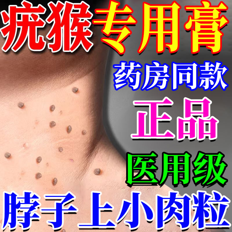 【疣瘊肉粒一抹无忧】克疣膏
