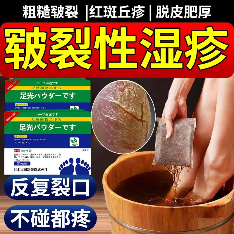 脚部湿疹脚背真菌感染止痒去角化型湿疹根泡脚药粉房同售干裂硬皮