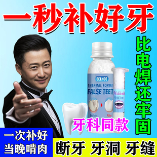 补牙神器自填充材料己永久医用进口树脂在临时家牙洞假牙缝粘合剂