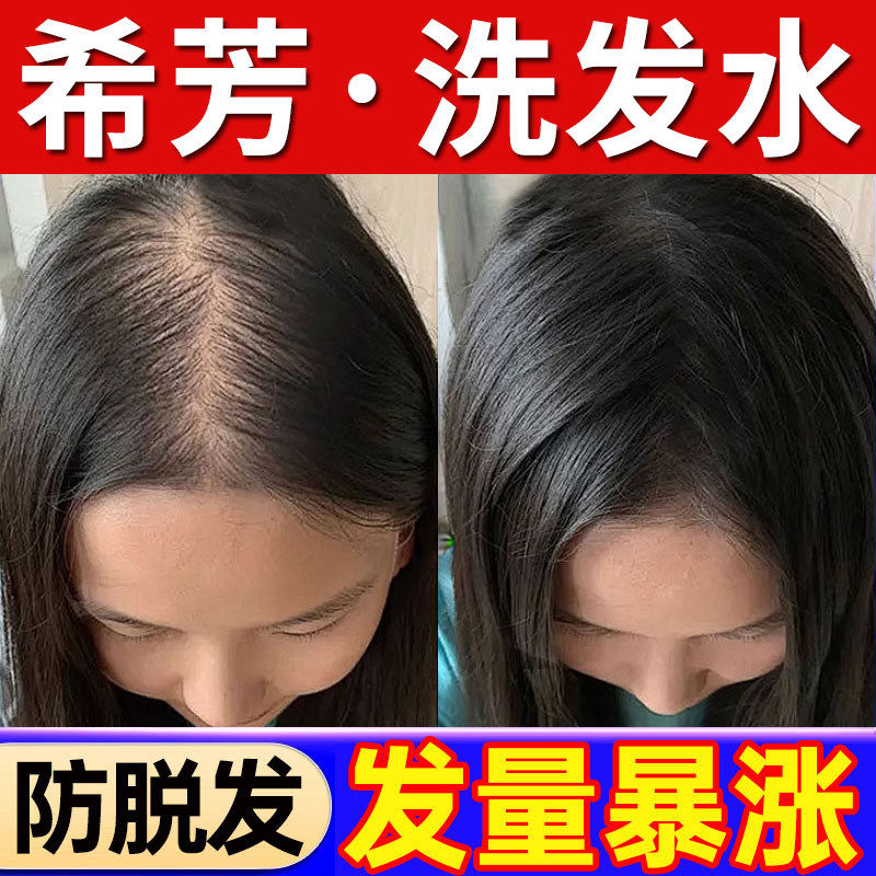 希芳生姜洗发水防脱育发控油蓬松去屑止痒西芳希方正品官方店