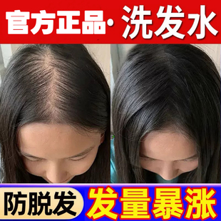 元 羽棠洗发水防脱密发生发去屑止痒蓬松控油胖东来官方店正品