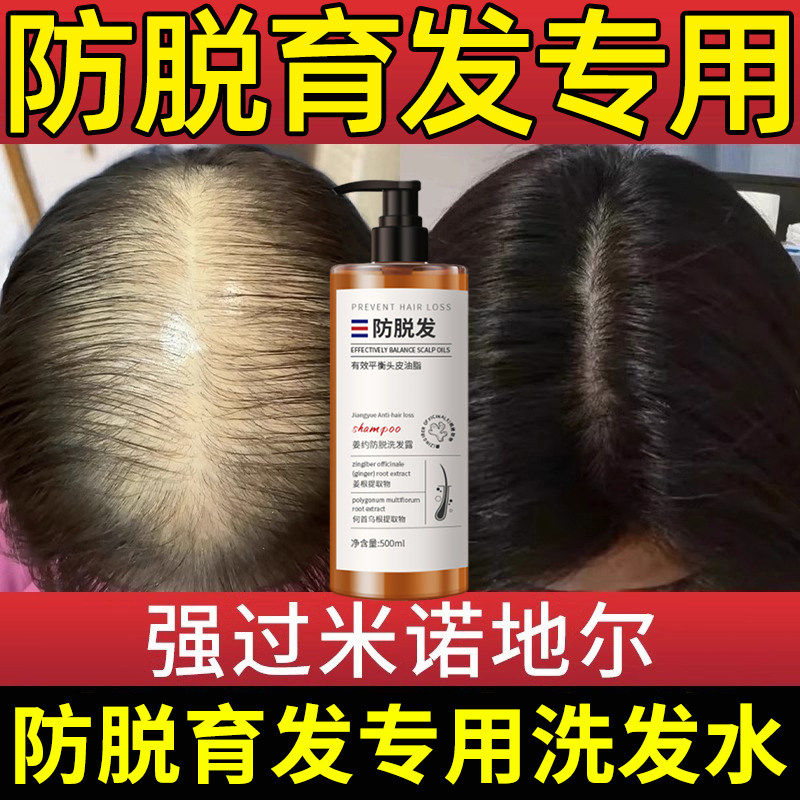 丰添防脱洗发水去屑止痒男士育发蓬松控油胖东来官方店正品