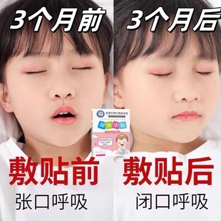 儿童腺样体贴鼻塞打呼面容矫正嘴突呼吸通气调理腺体打呼噜调理